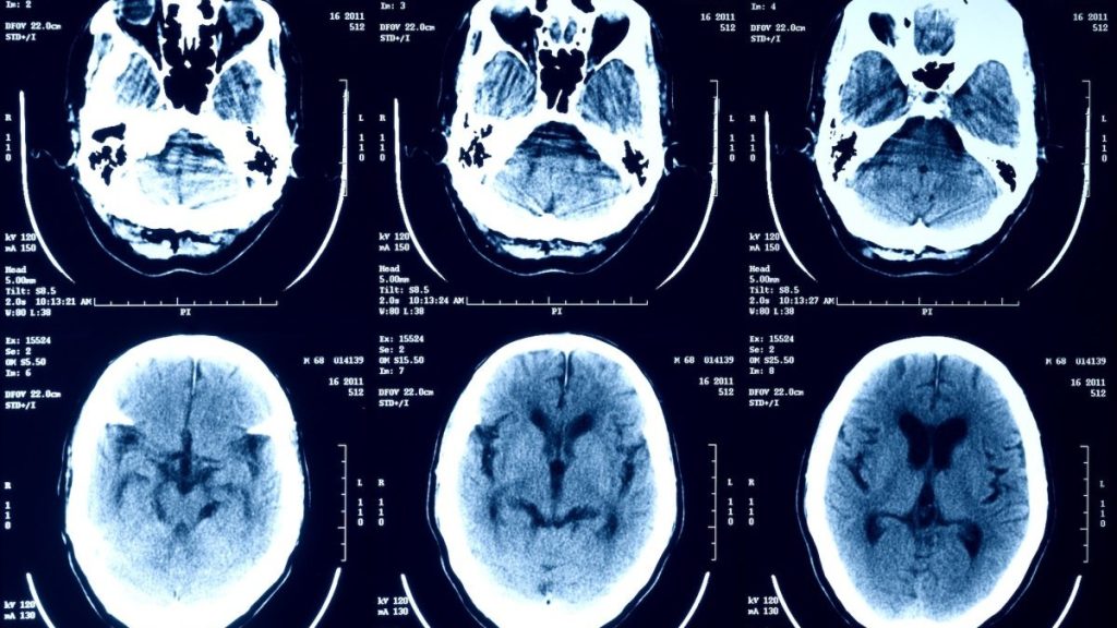 Episource avisa 5,4 milhões de pessoas nos EUA sobre roubo de dados de saúde